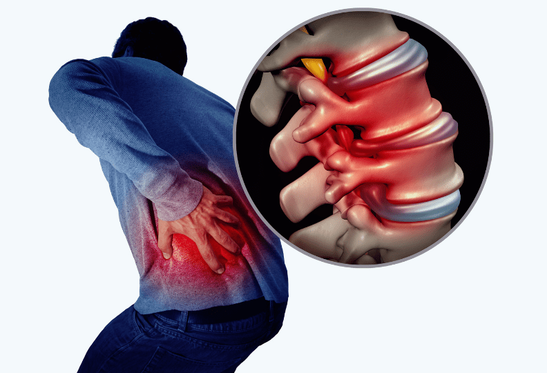 Causes of lower back pain - How To Beat Your Lower Back Pain